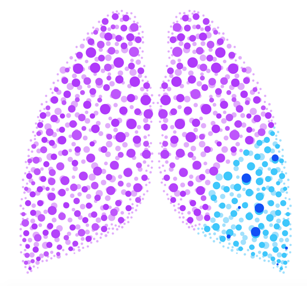 pulmones