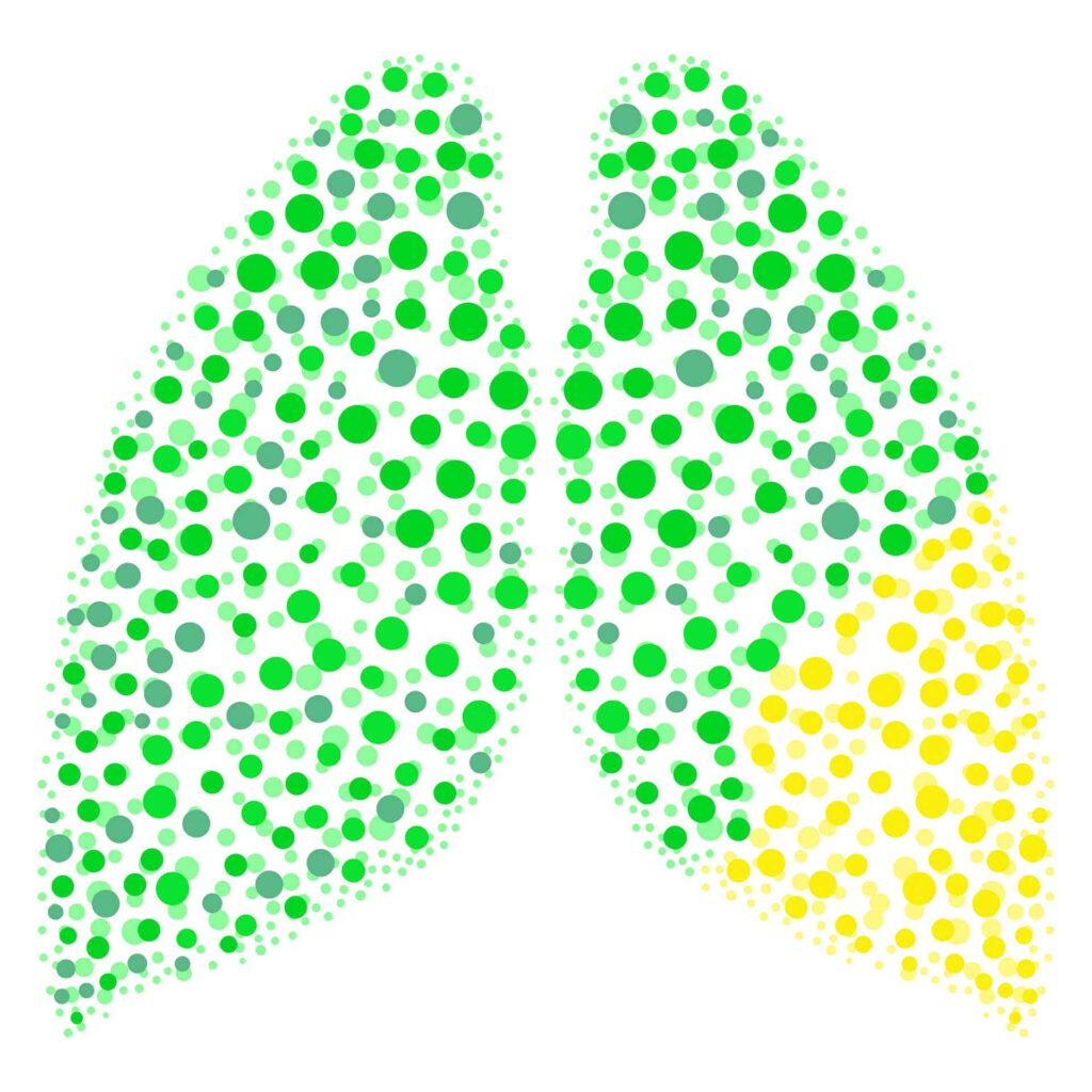 pulmones-VERDE-AMARILLO-baja